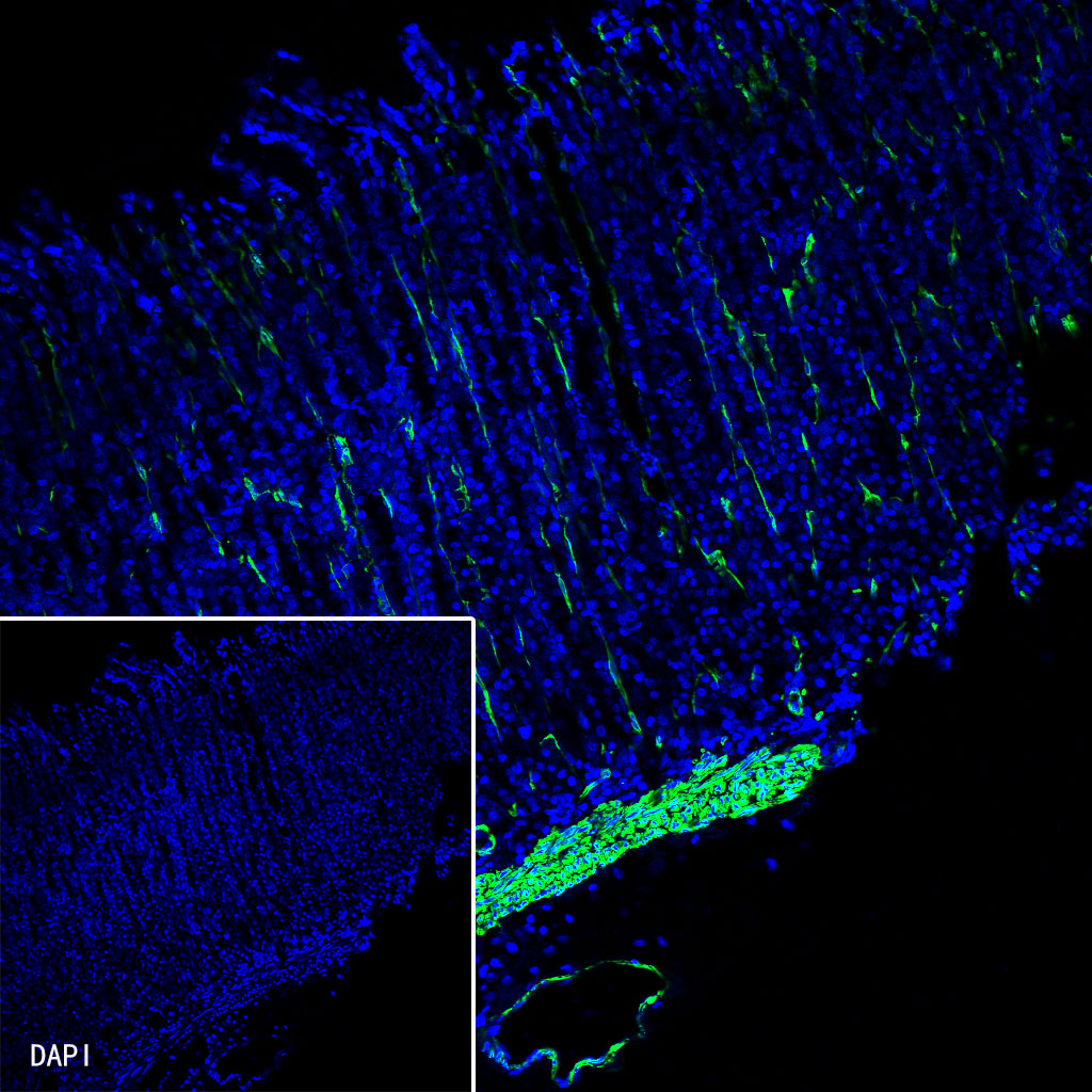 Rabbit anti-alpha smooth muscle Actin Recombinant Monoclonal Antibody(Alexa Fluor® 488 Conjugate)(132-63)