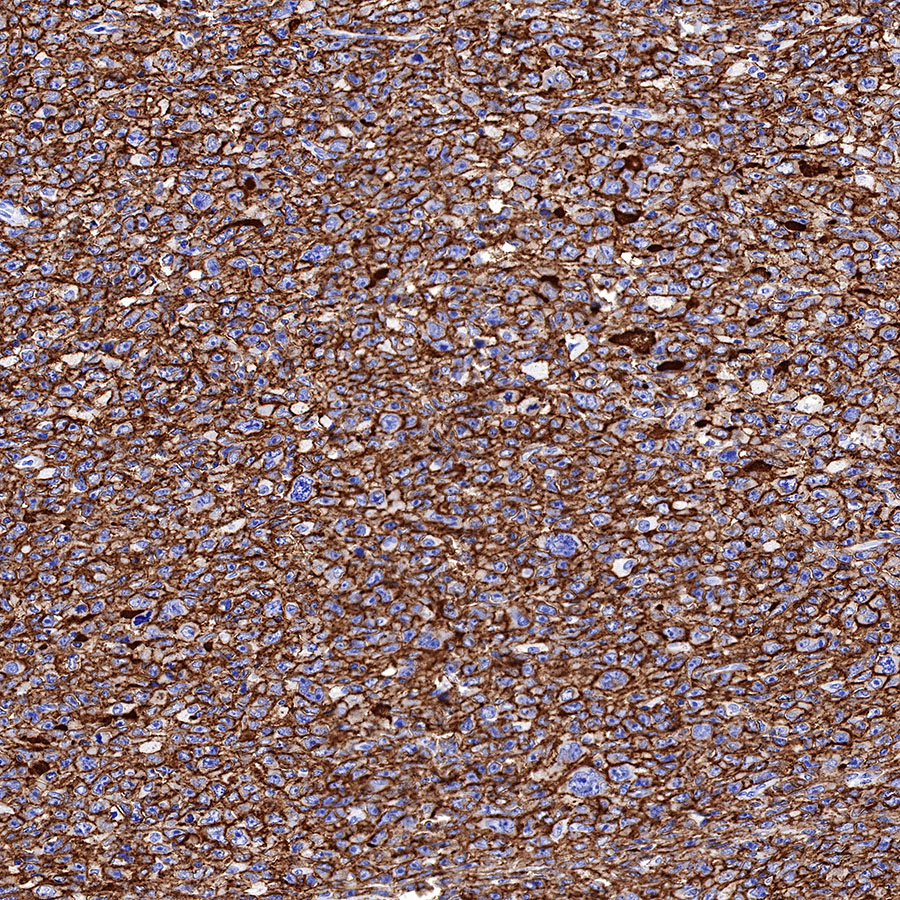 Rabbit anti-CD20 Recombinant Monoclonal Antibody(R133)
