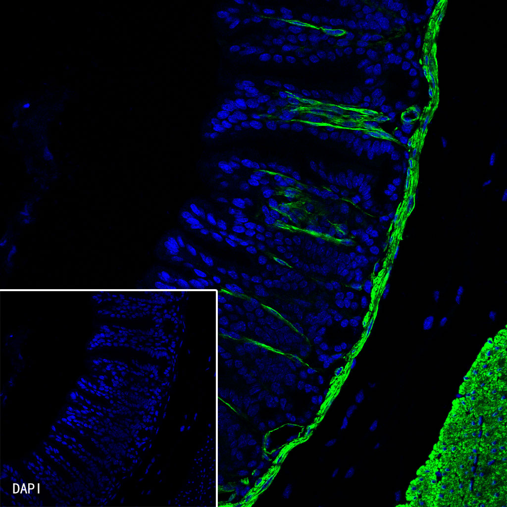 Rabbit anti-alpha smooth muscle Actin Recombinant Monoclonal Antibody(Alexa Fluor® 488 Conjugate)(132-63)