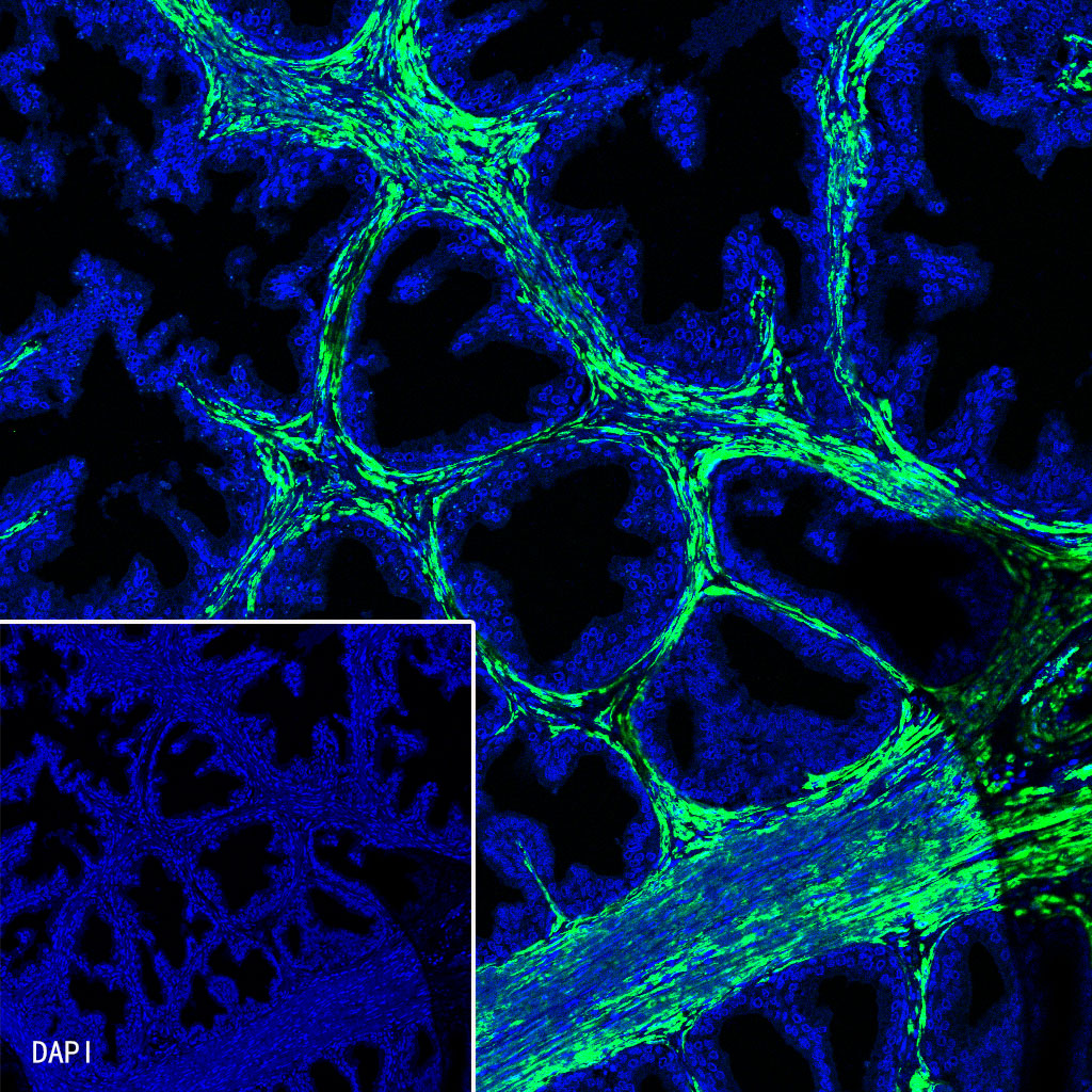 Rabbit anti-alpha smooth muscle Actin Recombinant Monoclonal Antibody(Alexa Fluor® 488 Conjugate)(132-63)