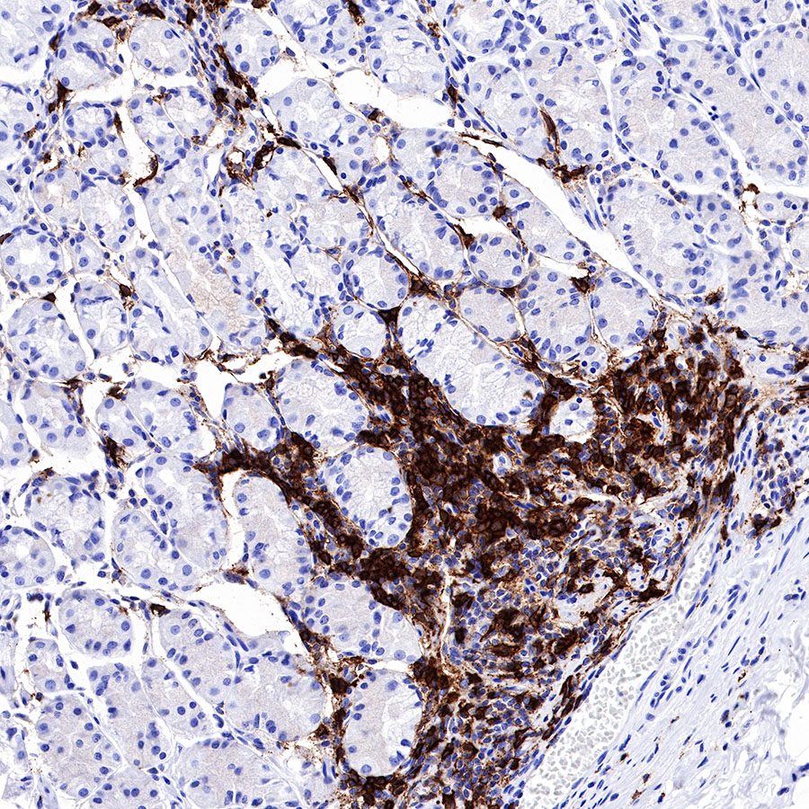 Rabbit anti-CD20 Recombinant Monoclonal Antibody(R133)