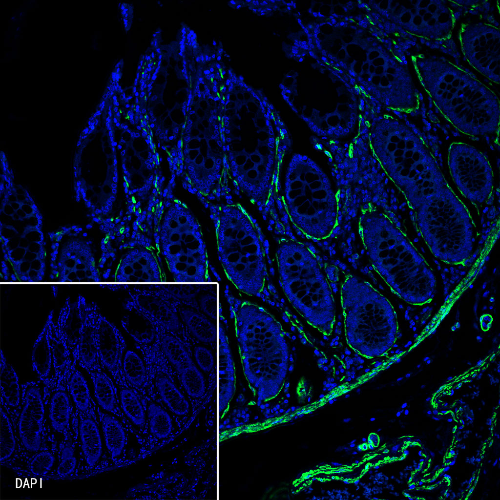 Rabbit anti-alpha smooth muscle Actin Recombinant Monoclonal Antibody(Alexa Fluor® 488 Conjugate)(132-63)