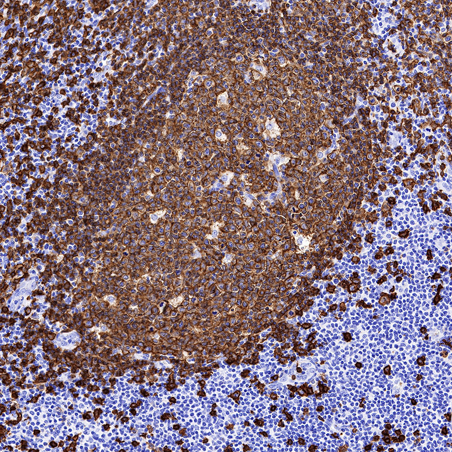 Rabbit anti-CD20 Recombinant Monoclonal Antibody(R133)