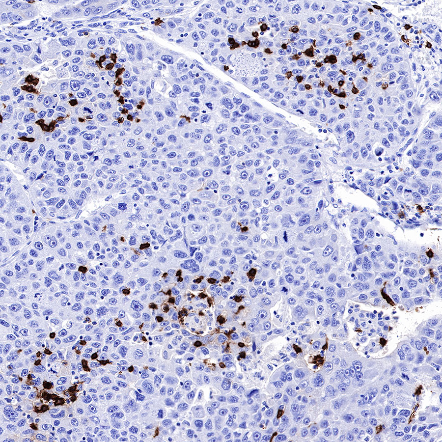 Rabbit anti-CD20 Recombinant Monoclonal Antibody(R133)
