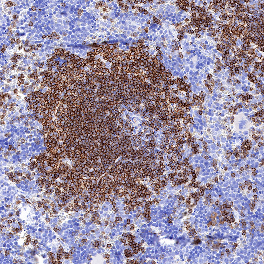 Rabbit anti-CD20 Recombinant Monoclonal Antibody(R133)