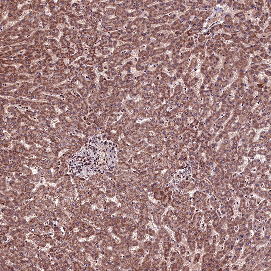 Rabbit anti-Acetyllysine Recombinant Monoclonal Antibody(R096)