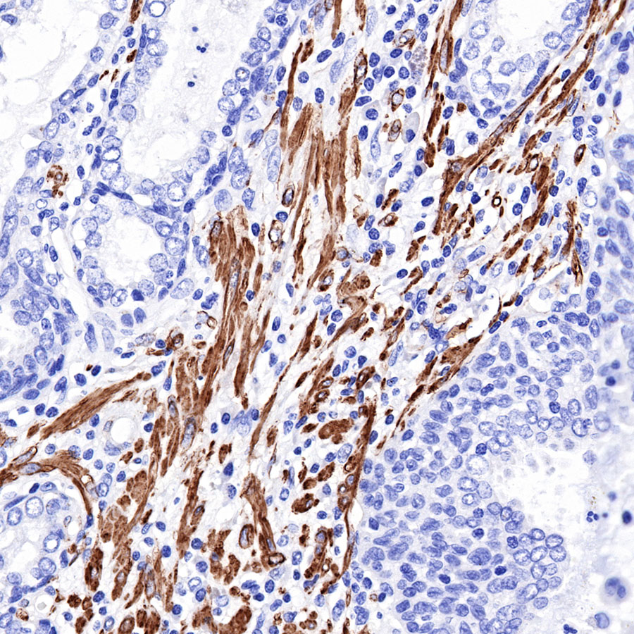Rabbit anti-α smooth muscle Actin(SMA) Recombinant Monoclonal Antibody(301-142)