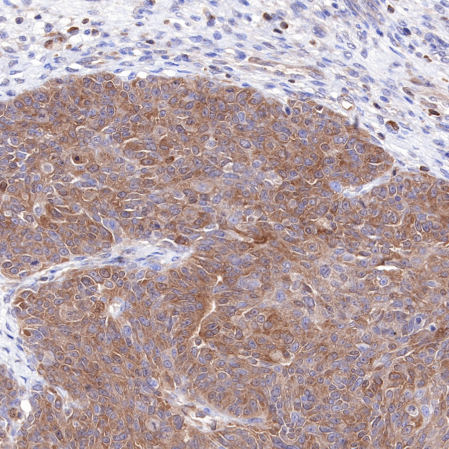 Rabbit anti-MEK1 Recombinant Monoclonal Antibody(308-32)