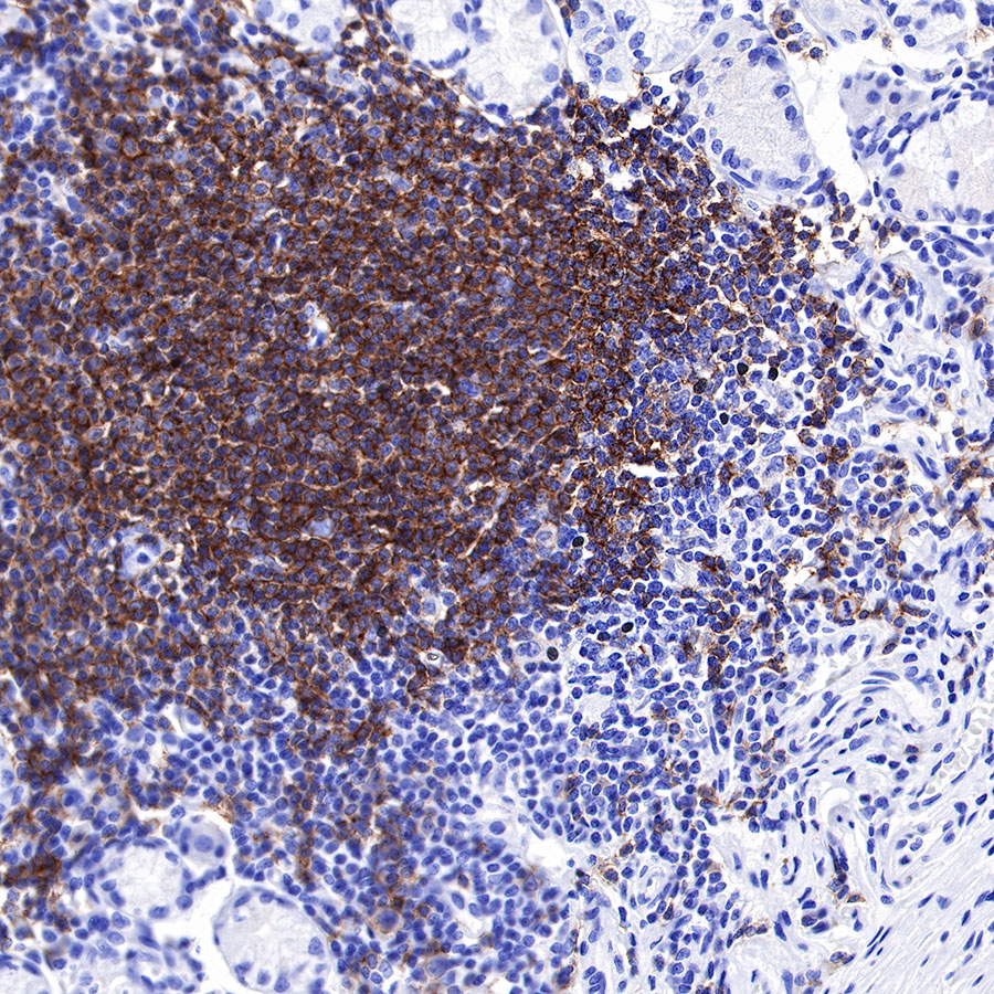 Rabbit anti-CD19 Recombinant Monoclonal Antibody(164-33)