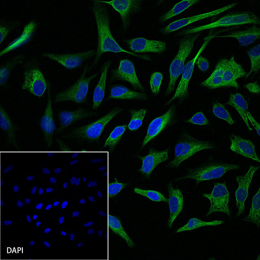 Rabbit anti-MEK1 Recombinant Monoclonal Antibody(308-32)