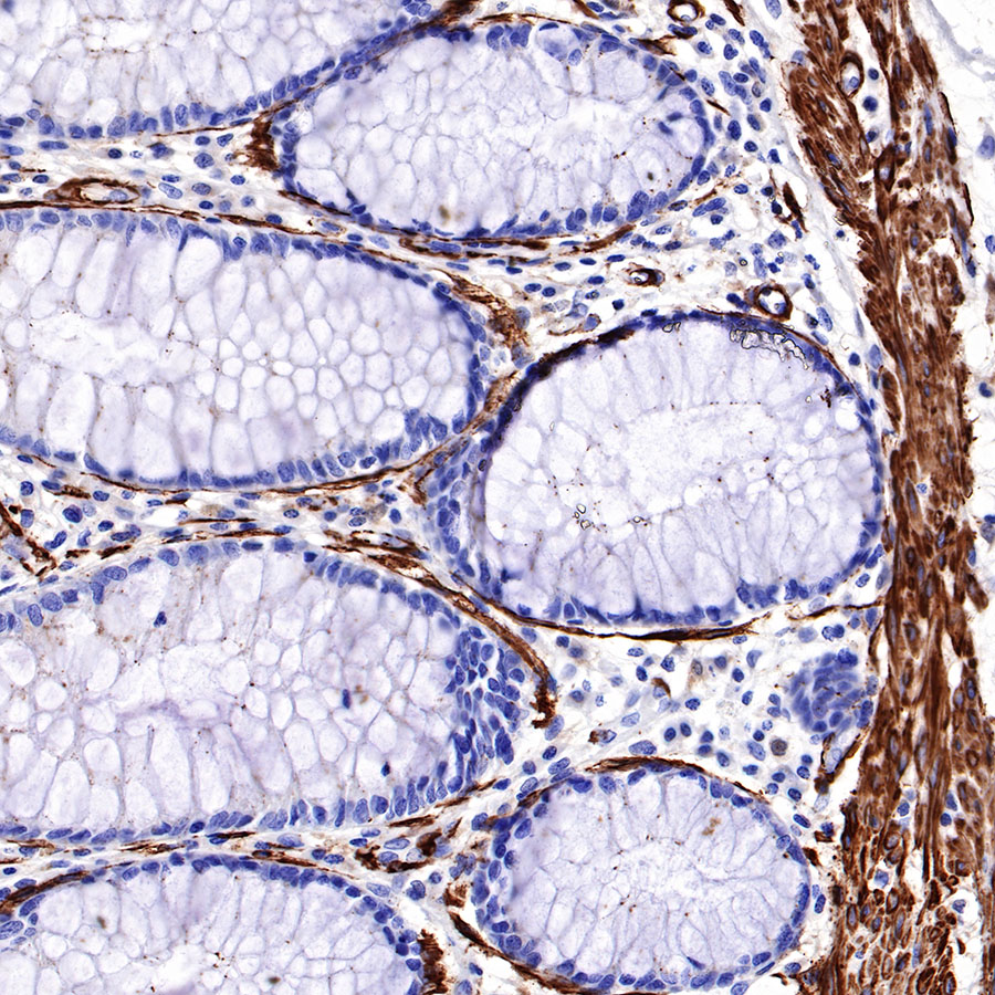 Rabbit anti-α smooth muscle Actin(SMA) Recombinant Monoclonal Antibody(301-142)