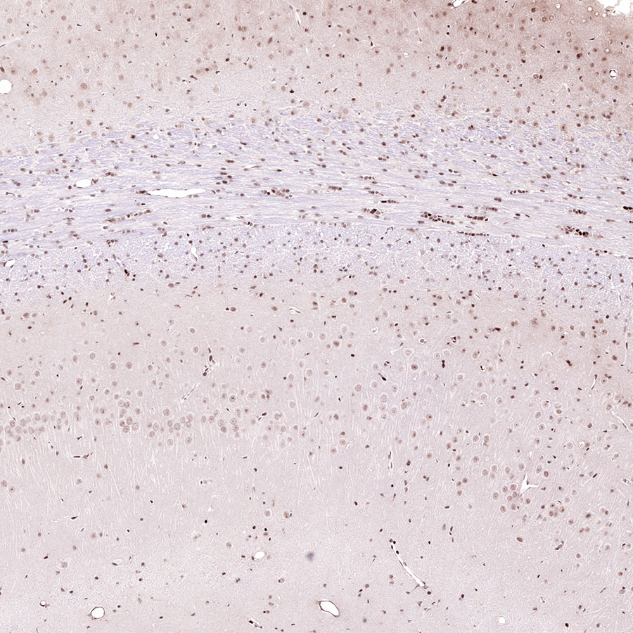 Rabbit anti-Acetyllysine Recombinant Monoclonal Antibody(R096)
