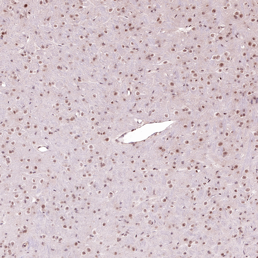 Rabbit anti-Acetyllysine Recombinant Monoclonal Antibody(R096)