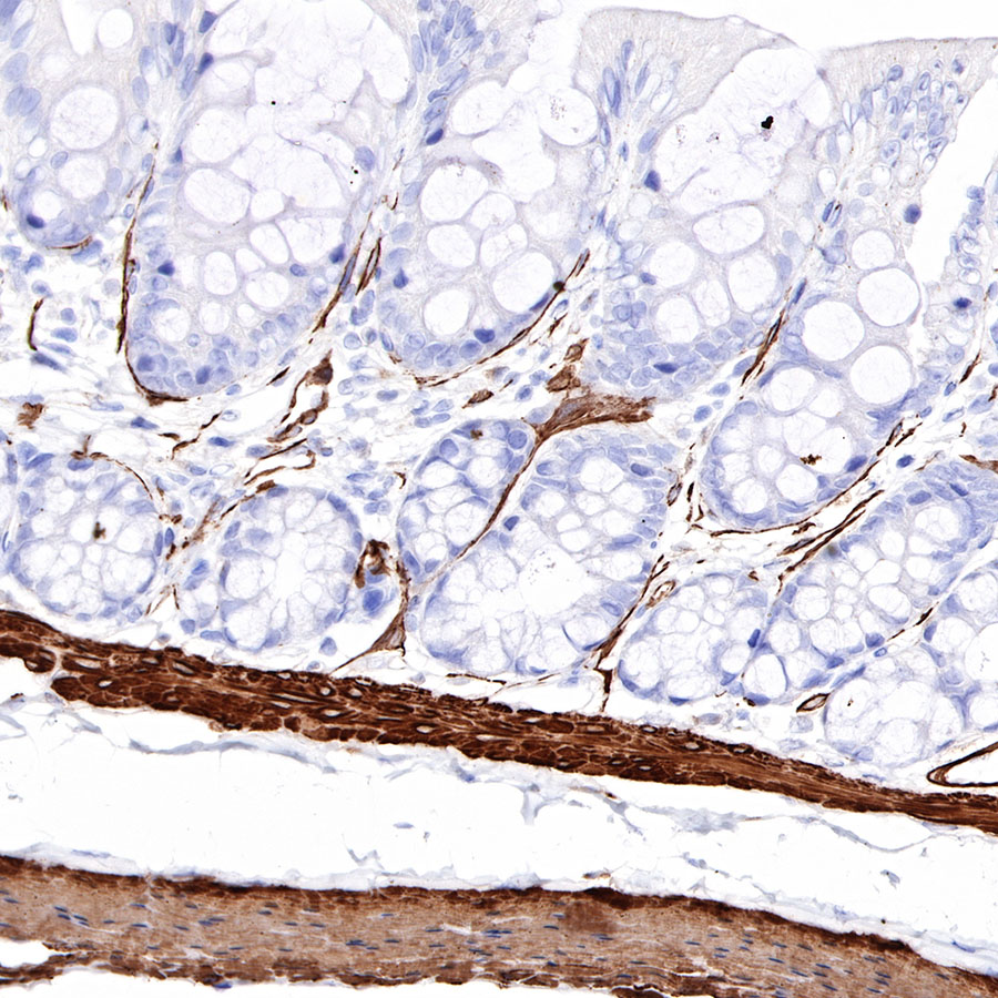 Rabbit anti-α smooth muscle Actin(SMA) Recombinant Monoclonal Antibody(301-142)