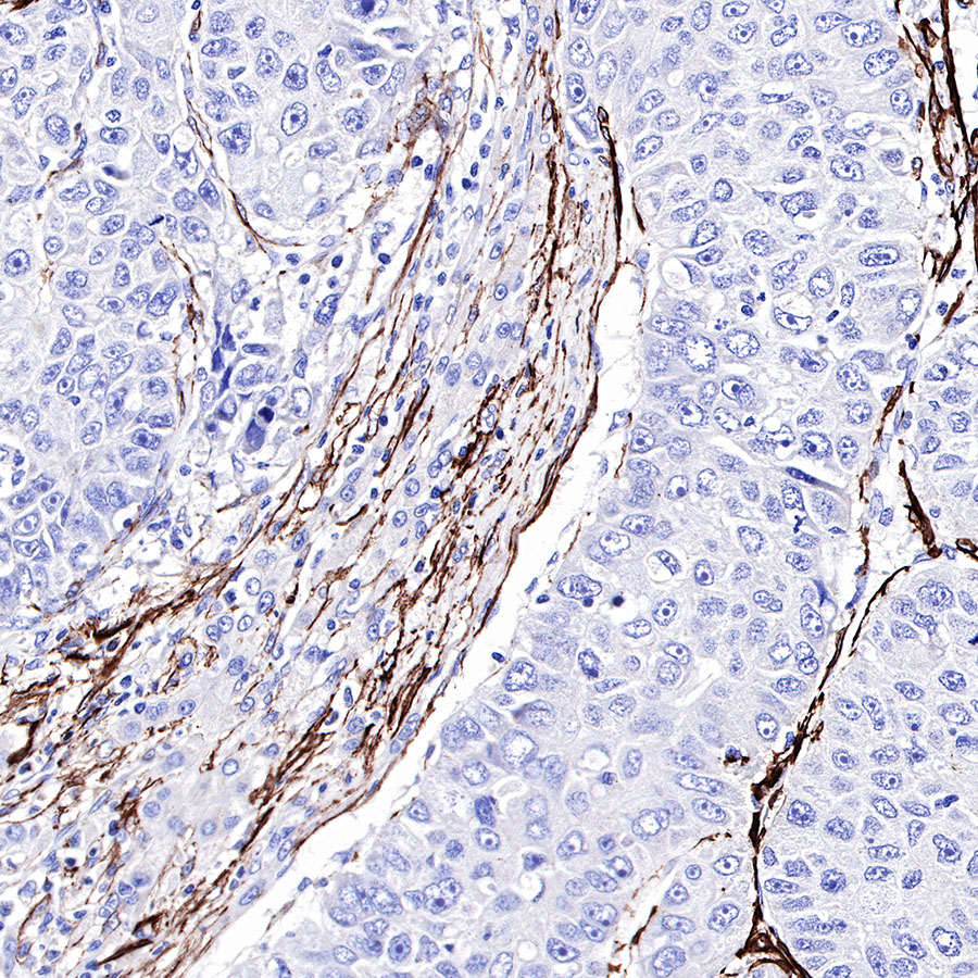 Rabbit anti-α smooth muscle Actin(SMA) Recombinant Monoclonal Antibody(301-142)