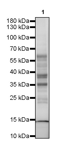 Rabbit anti-Acetyllysine Recombinant Monoclonal Antibody(R096)