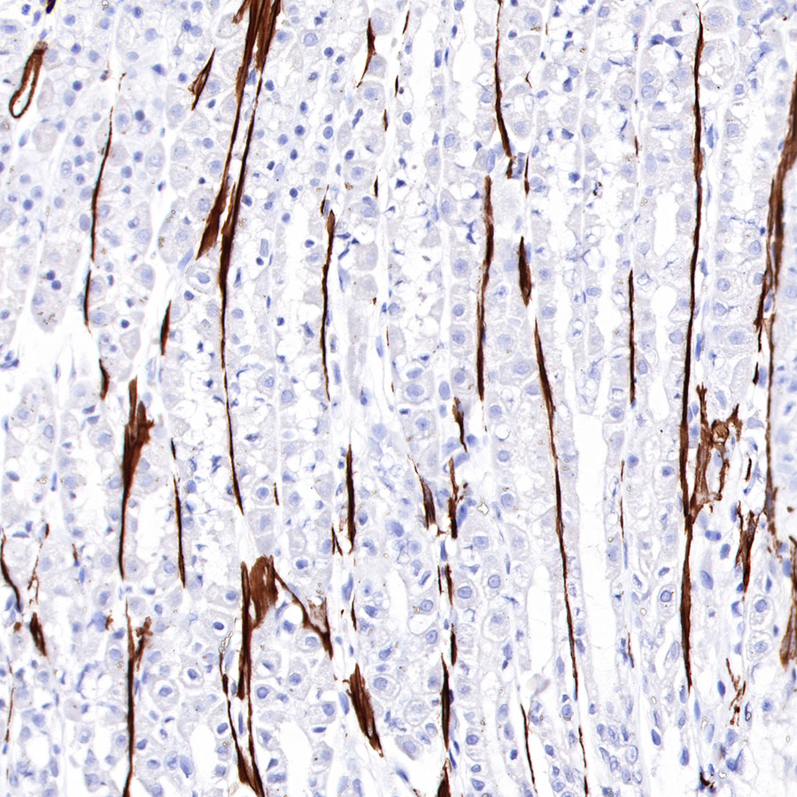 Rabbit anti-α smooth muscle Actin(SMA) Recombinant Monoclonal Antibody(301-142)