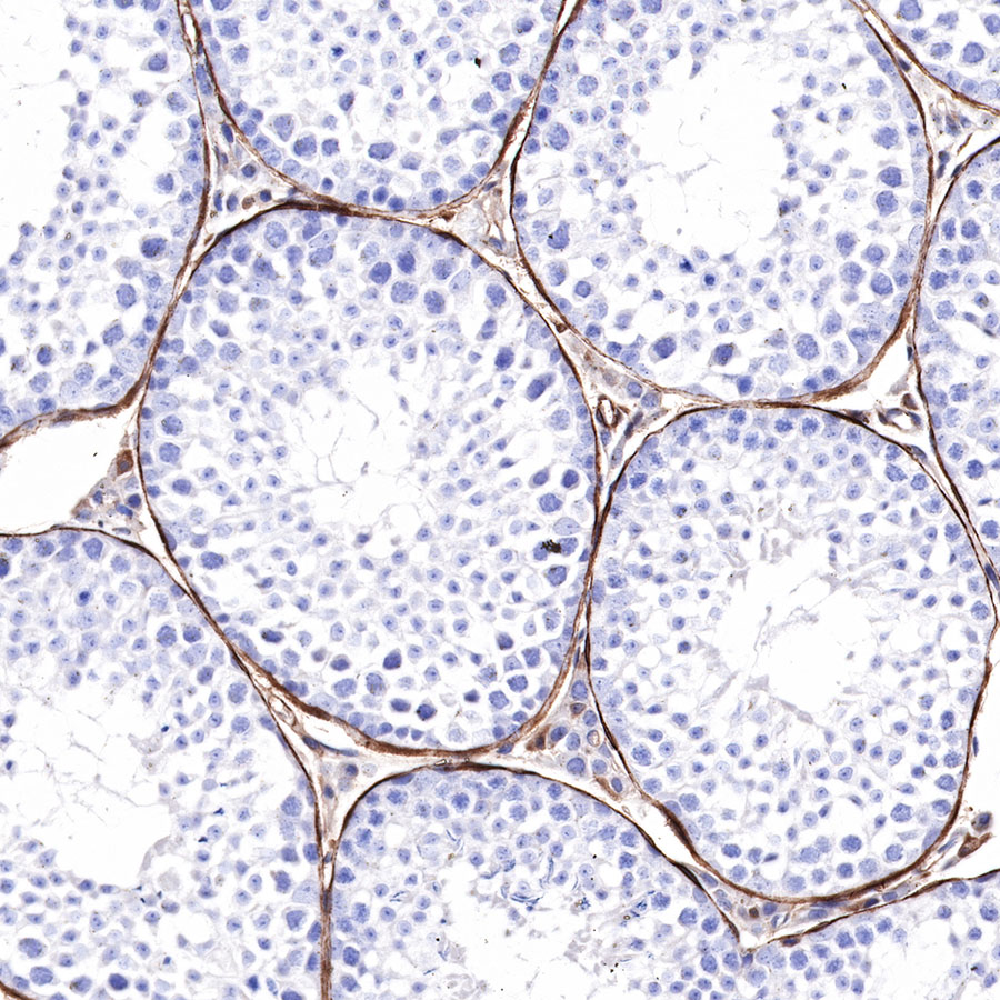 Rabbit anti-α smooth muscle Actin(SMA) Recombinant Monoclonal Antibody(301-142)