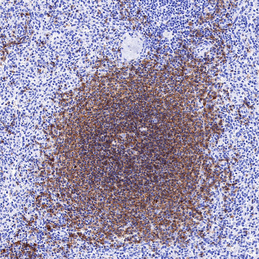 Rabbit anti-CD19 Recombinant Monoclonal Antibody(164-33)