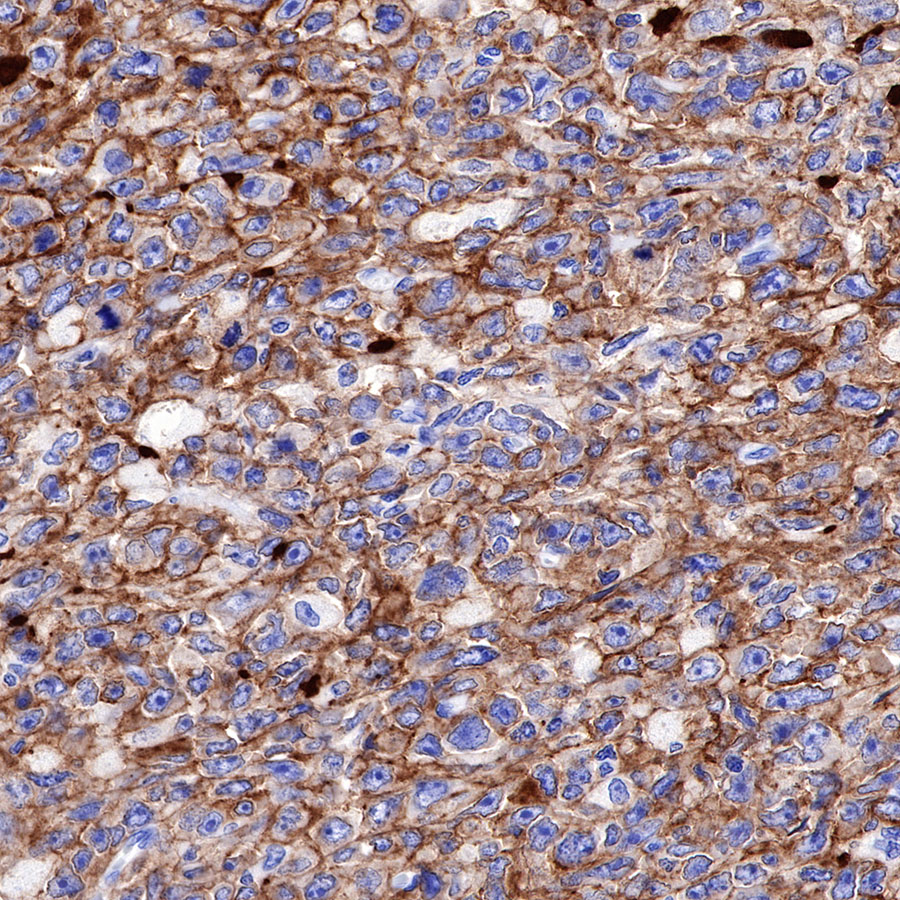 Rabbit anti-CD19 Recombinant Monoclonal Antibody(164-33)