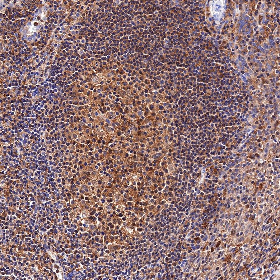 Rabbit anti-MEK1 Recombinant Monoclonal Antibody(308-32)