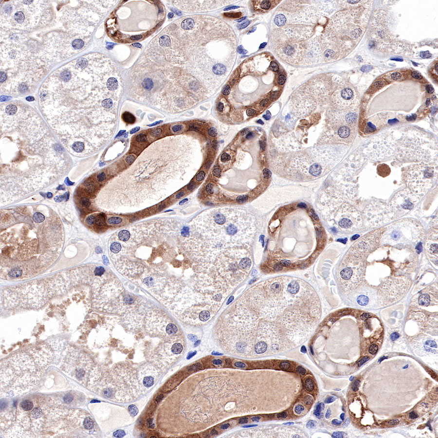 Rabbit anti-MEK1 Recombinant Monoclonal Antibody(308-32)