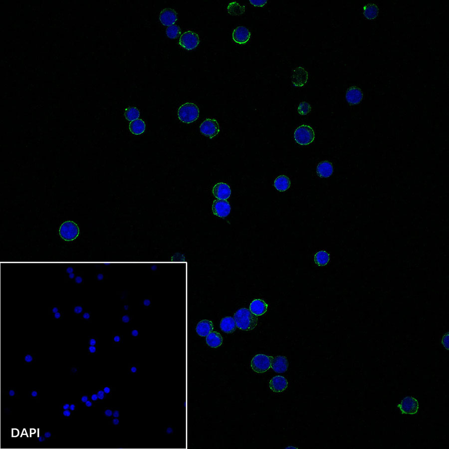 Rabbit anti-CD19 Recombinant Monoclonal Antibody(164-33)
