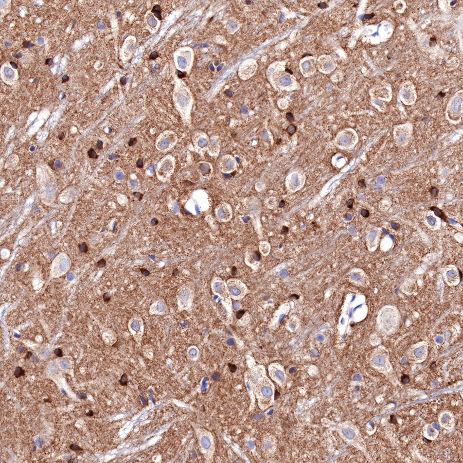 Mouse anti-Tau Recombinant Monoclonal Antibody(R145)