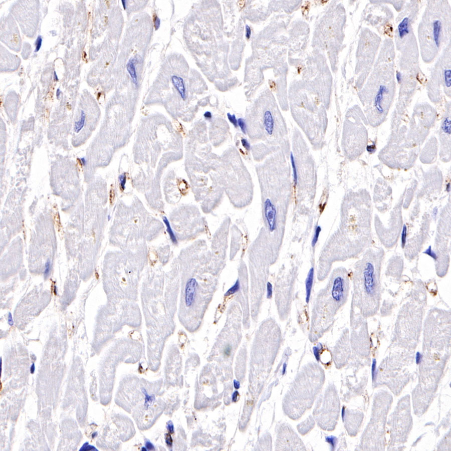 Rabbit anti-C4d Recombinant Monoclonal Antibody(330-2)