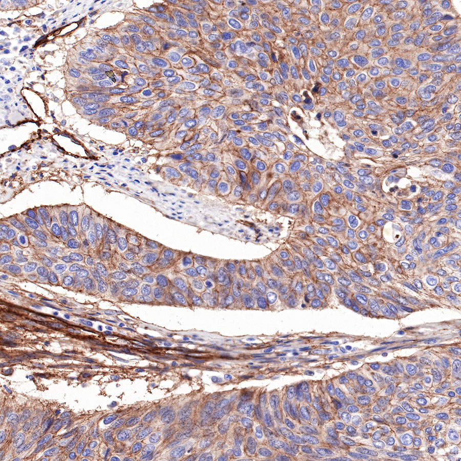 Rabbit anti-CD276 Recombinant Monoclonal Antibody(R158)