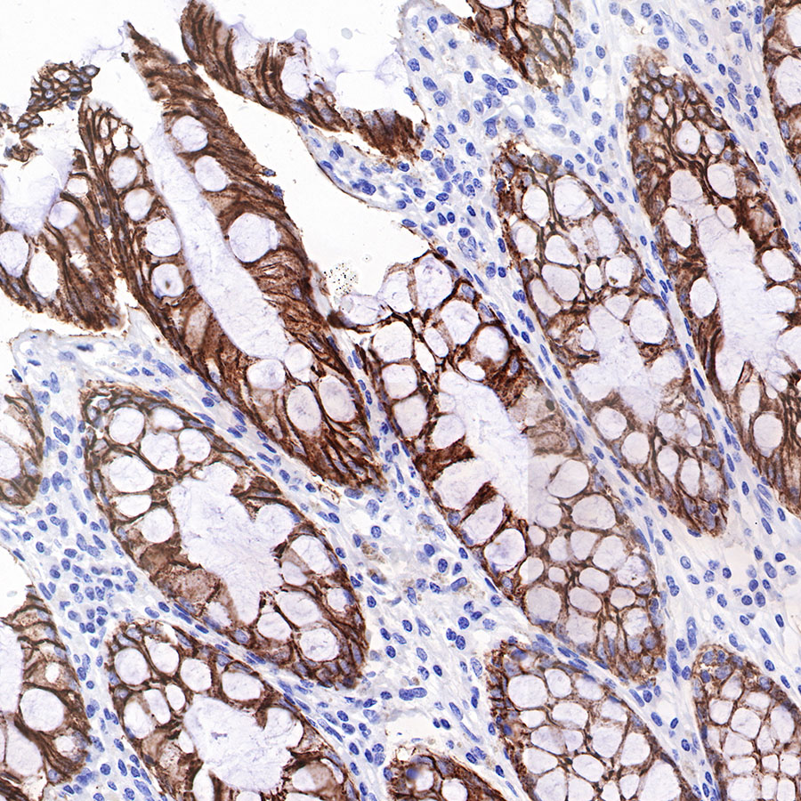 Rabbit anti-Cadherin 17 Recombinant Monoclonal Antibody(R151)