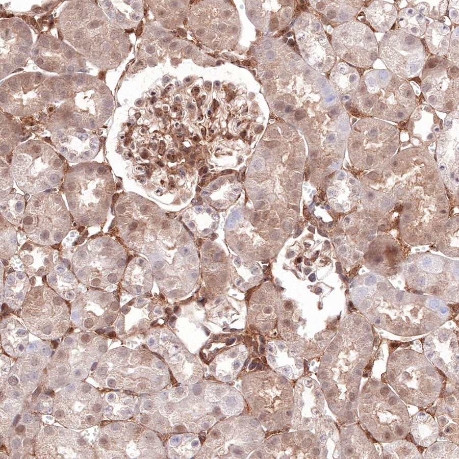 Rabbit anti-Stat6 Recombinant Monoclonal Antibody(337-32)