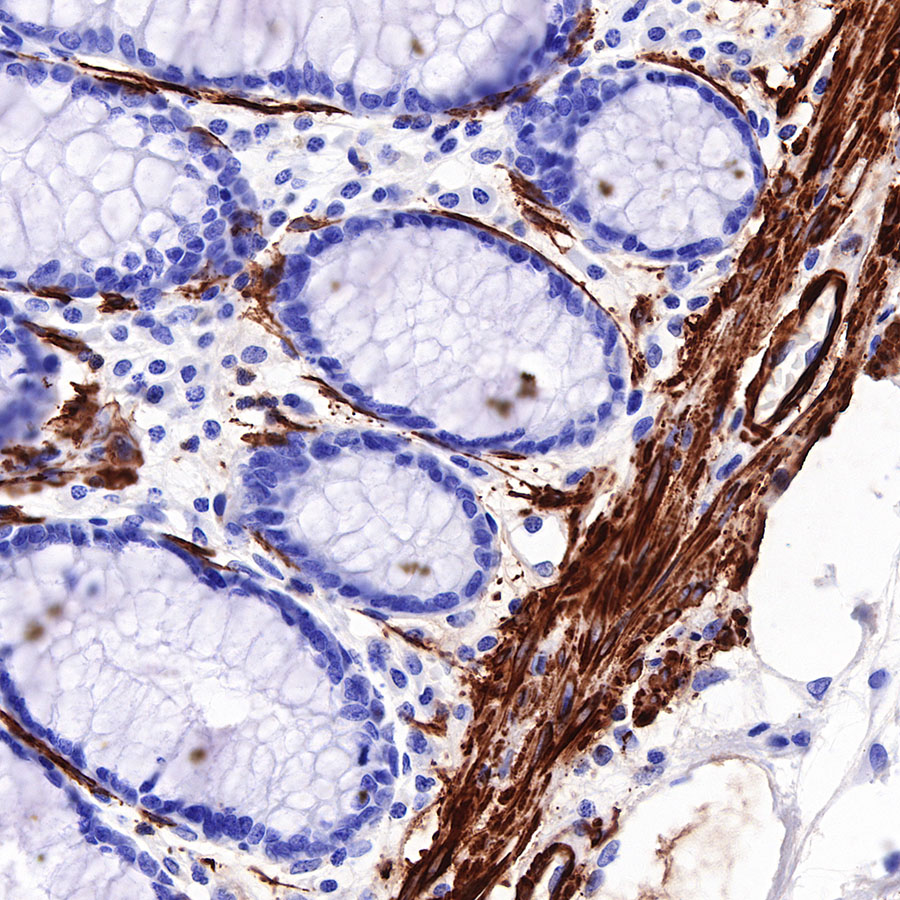 Rabbit anti-Myosin-11 Recombinant Monoclonal Antibody(188-112)
