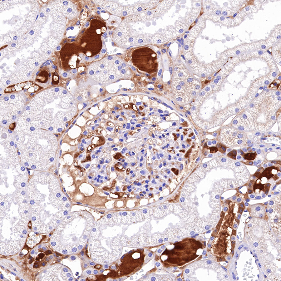 Rabbit anti-C4d Recombinant Monoclonal Antibody(330-2)