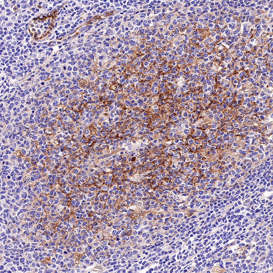 Rabbit anti-C4d Recombinant Monoclonal Antibody(330-2)
