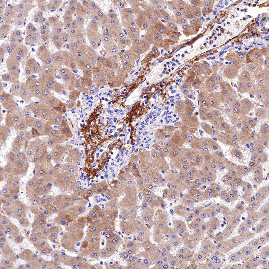 Rabbit anti-C4d Recombinant Monoclonal Antibody(330-2)