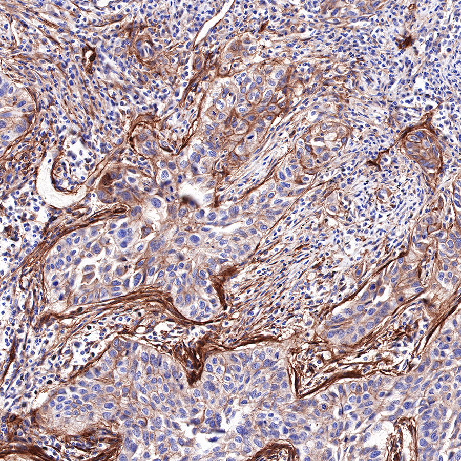 Rabbit anti-CD276 Recombinant Monoclonal Antibody(R158)