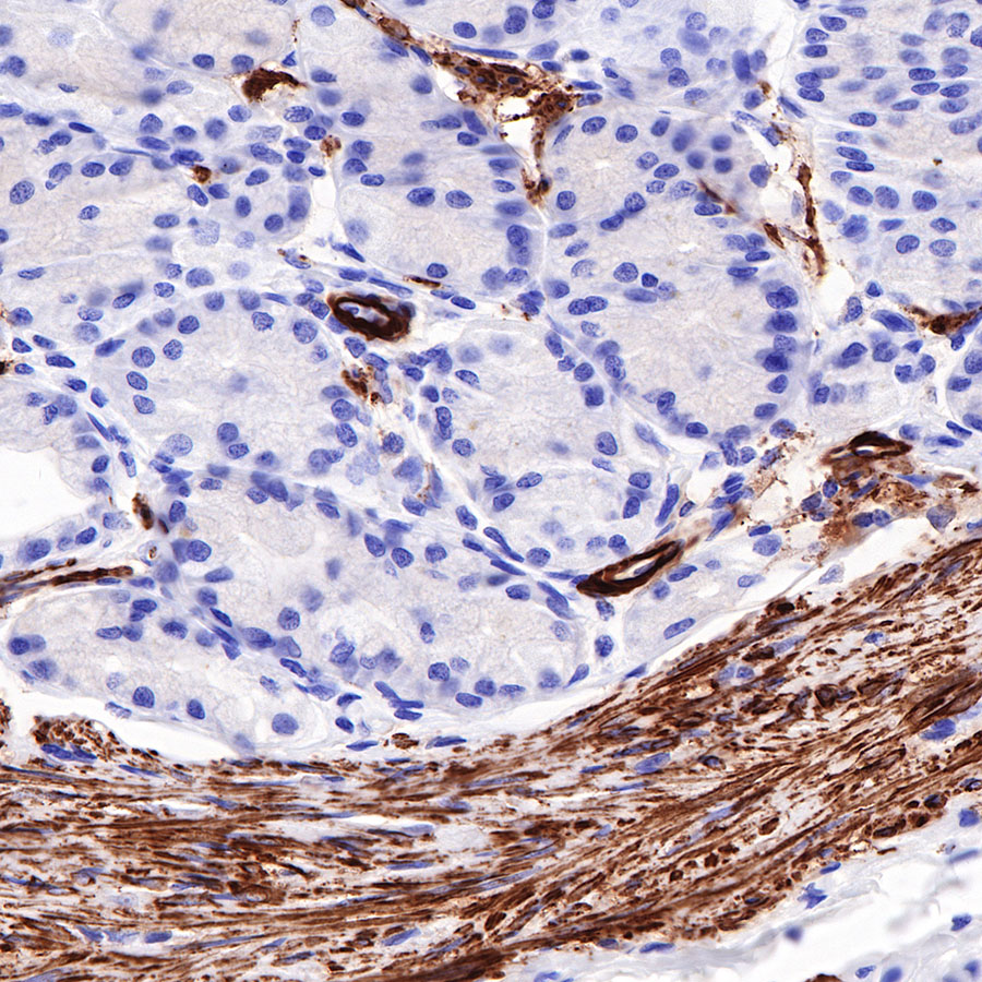 Rabbit anti-Myosin-11 Recombinant Monoclonal Antibody(188-112)