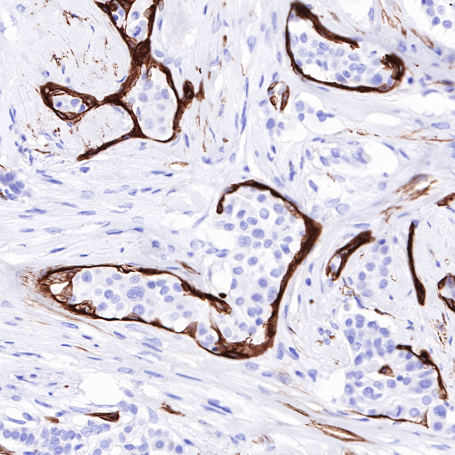Rabbit anti-Myosin-11 Recombinant Monoclonal Antibody(188-112)