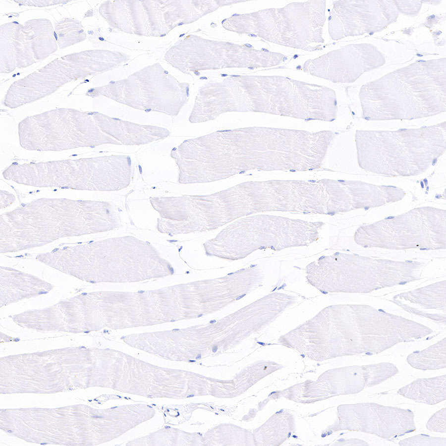 Rabbit anti-Cadherin 17 Recombinant Monoclonal Antibody(R151)