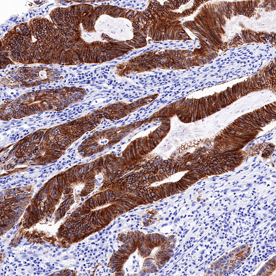Rabbit anti-Cadherin 17 Recombinant Monoclonal Antibody(R151)