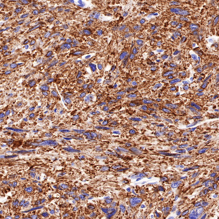 Rabbit anti-Myosin-11 Recombinant Monoclonal Antibody(188-112)