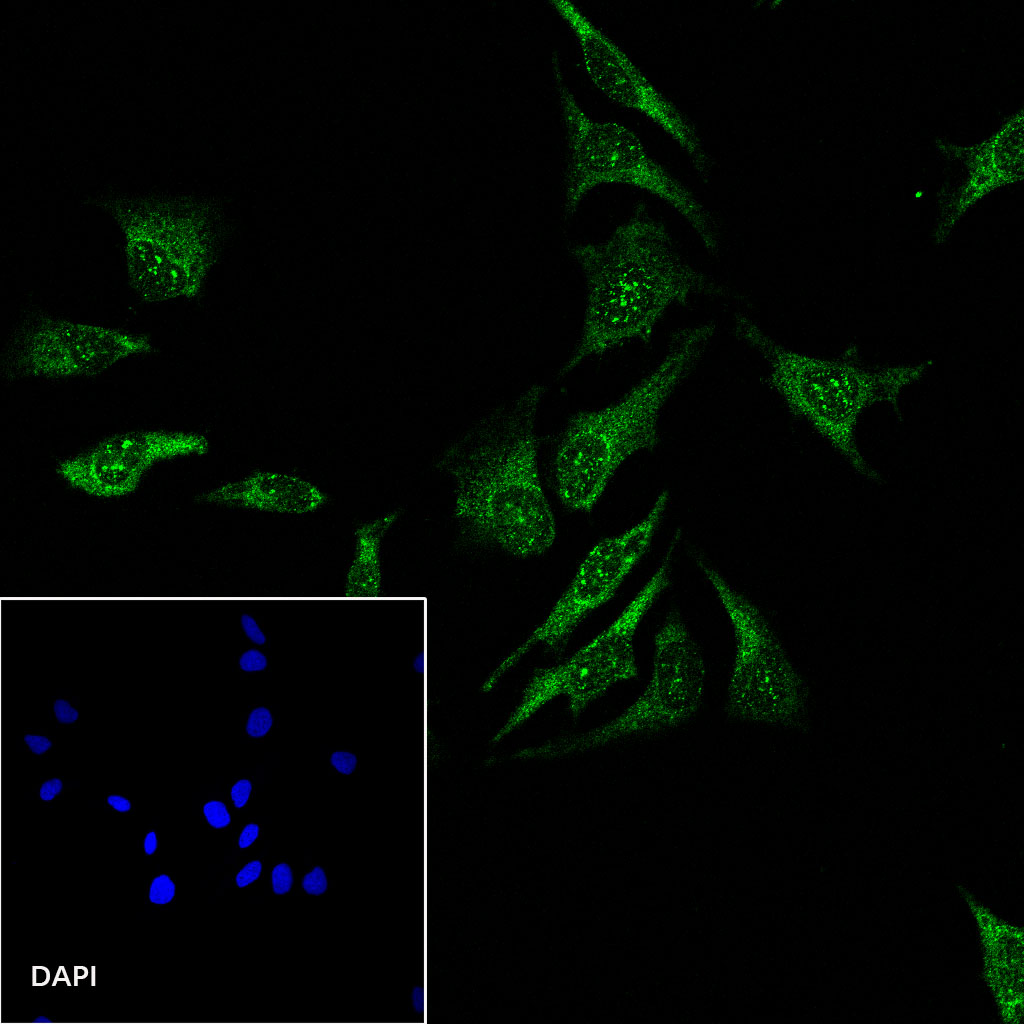 Rabbit anti-Stat6 Recombinant Monoclonal Antibody(337-32)