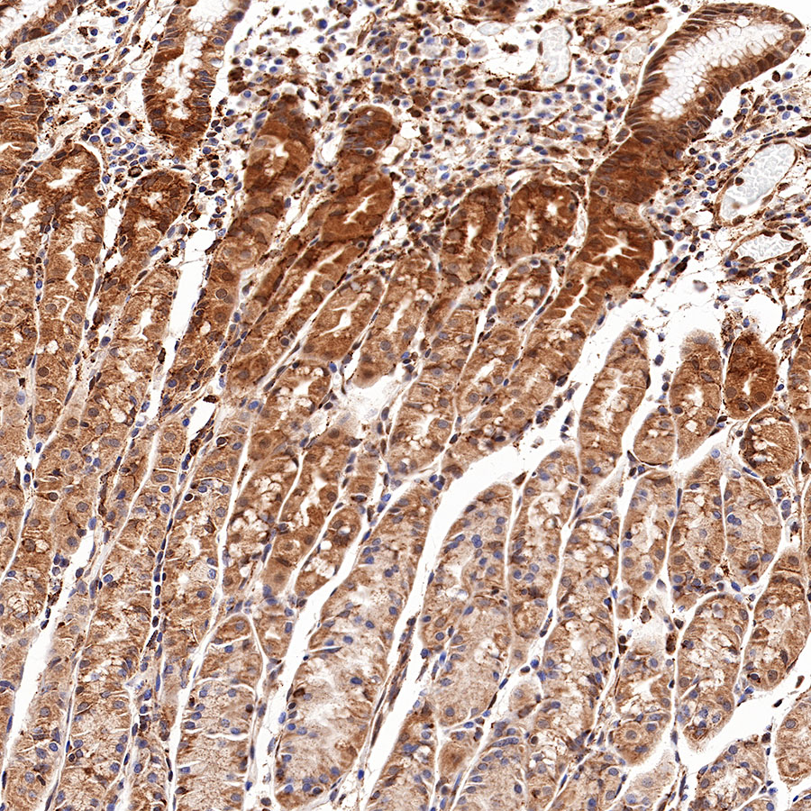 Rabbit anti-Stat6 Recombinant Monoclonal Antibody(337-32)