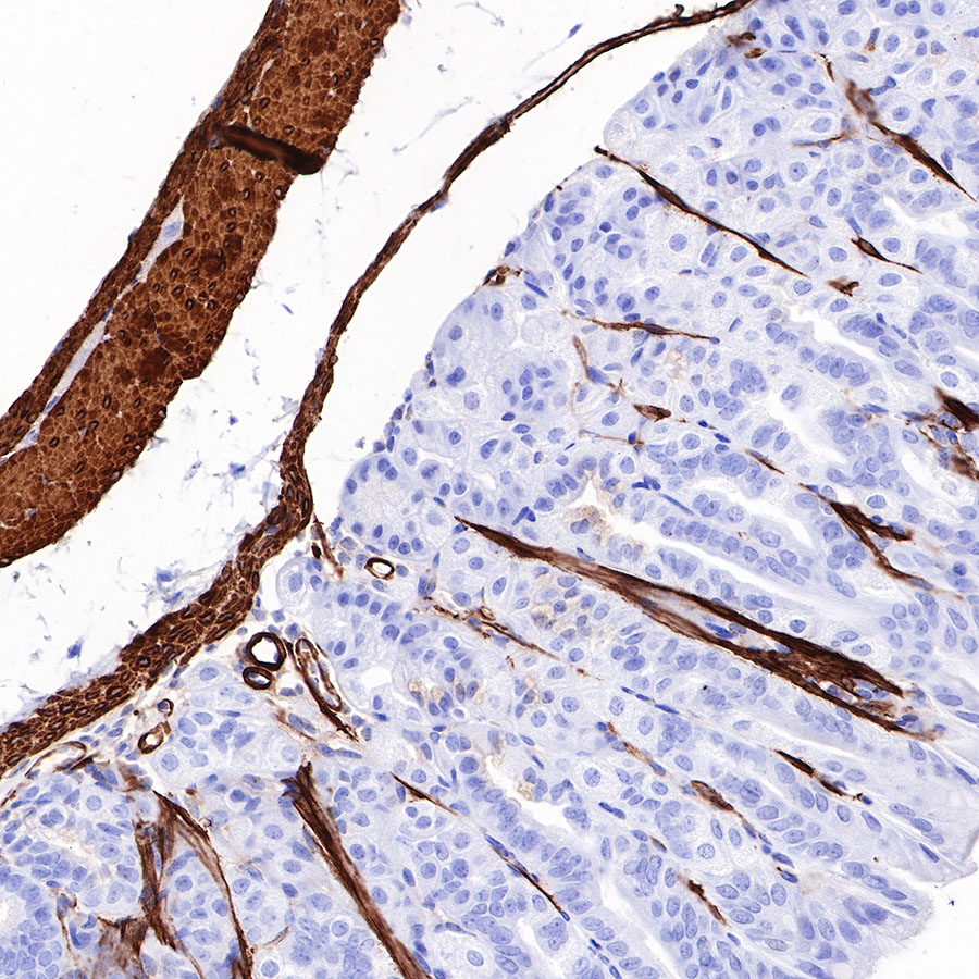 Rabbit anti-Myosin-11 Recombinant Monoclonal Antibody(188-112)
