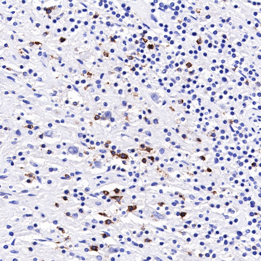Rabbit anti-LAG3 Recombinant Monoclonal Antibody(R159)