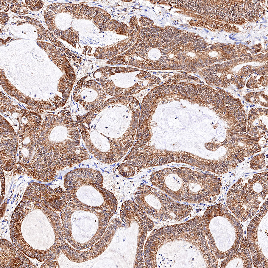 Rabbit anti-Stat6 Recombinant Monoclonal Antibody(337-32)