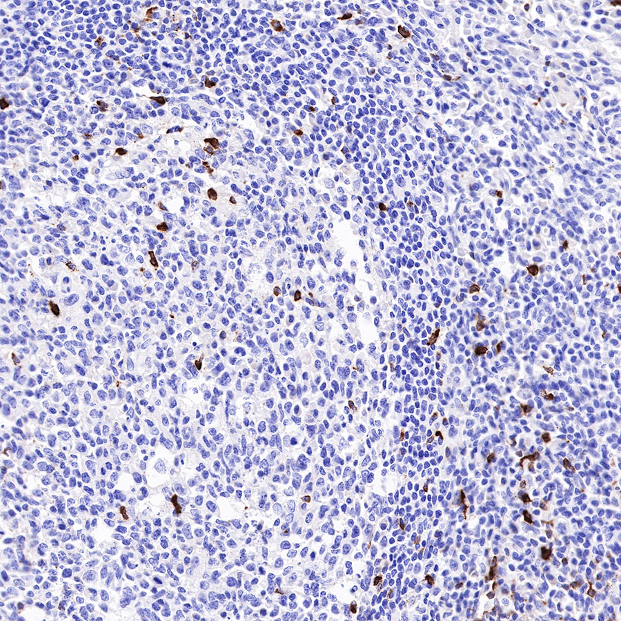 Rabbit anti-LAG3 Recombinant Monoclonal Antibody(R159)