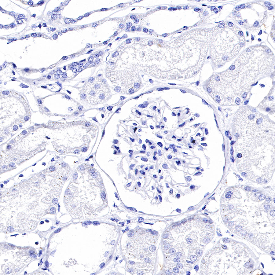 Rabbit anti-GPA33 Recombinant Monoclonal Antibody(248-76)