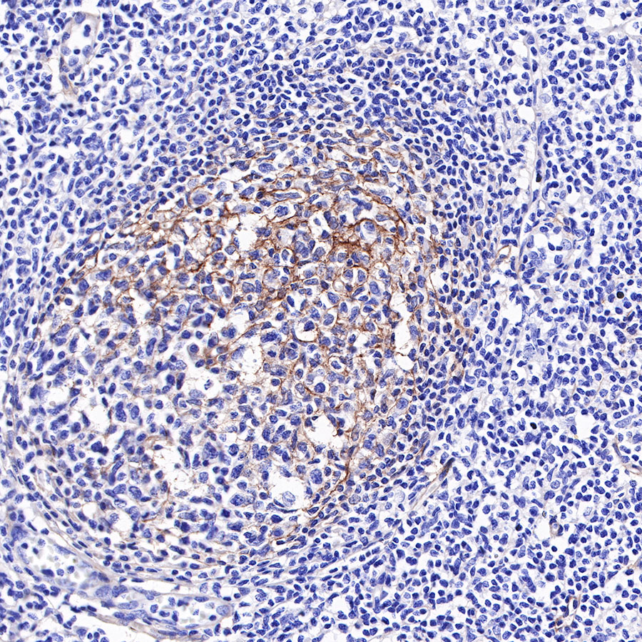 Rabbit anti-CD276 Recombinant Monoclonal Antibody(R158)